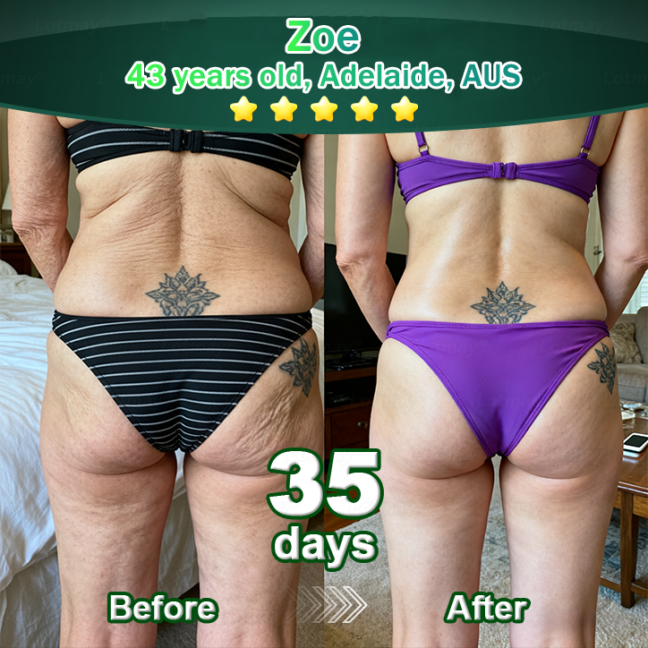 𝐎𝐟𝐟𝐢𝐜𝐢𝐚𝐥𝐥𝐲 𝐀𝐮𝐭𝐡𝐨𝐫𝐢𝐬𝐞𝐝 𝑬𝒙𝒄𝒍𝒖𝒔𝒊𝒗𝒆 𝑬𝒅𝒊𝒕𝒊𝒐𝒏✅𝑇𝑟𝑖𝑙𝑢𝑚𝑖𝑎® 𝖢𝗁𝗅𝗈𝗋𝗈𝗉𝗁𝗒𝗅𝗅 & 𝑆𝑡𝑒𝑚 𝐶𝑒𝑙𝑙 𝖻𝗈𝖽𝗒 𝗋𝖾𝗇𝖾𝗐𝖺𝗅 𝗌𝖾𝗋𝗎𝗆（𝐿𝑖𝑓𝑡 & 𝐹𝑖𝑟𝑚 𝑆𝑎𝑔𝑔𝑖𝑛𝑔 𝑆𝑘𝑖𝑛 & 𝑅𝑒𝑑𝑢𝑐𝑒 𝑊𝑟𝑖𝑛𝑘𝑙𝑒 𝐹𝑜𝑟𝑚𝑎𝑡𝑖𝑜𝑛😈