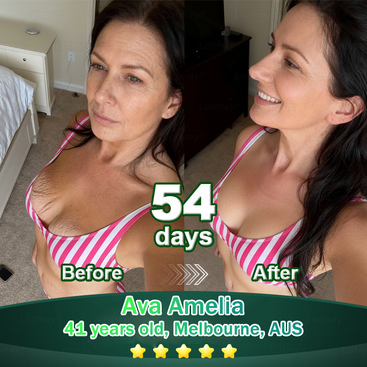 𝐎𝐟𝐟𝐢𝐜𝐢𝐚𝐥𝐥𝐲 𝐀𝐮𝐭𝐡𝐨𝐫𝐢𝐬𝐞𝐝 𝑬𝒙𝒄𝒍𝒖𝒔𝒊𝒗𝒆 𝑬𝒅𝒊𝒕𝒊𝒐𝒏✅𝑇𝑟𝑖𝑙𝑢𝑚𝑖𝑎® 𝖢𝗁𝗅𝗈𝗋𝗈𝗉𝗁𝗒𝗅𝗅 & 𝑆𝑡𝑒𝑚 𝐶𝑒𝑙𝑙 𝖻𝗈𝖽𝗒 𝗋𝖾𝗇𝖾𝗐𝖺𝗅 𝗌𝖾𝗋𝗎𝗆（𝐿𝑖𝑓𝑡 & 𝐹𝑖𝑟𝑚 𝑆𝑎𝑔𝑔𝑖𝑛𝑔 𝑆𝑘𝑖𝑛 & 𝑅𝑒𝑑𝑢𝑐𝑒 𝑊𝑟𝑖𝑛𝑘𝑙𝑒 𝐹𝑜𝑟𝑚𝑎𝑡𝑖𝑜𝑛😈